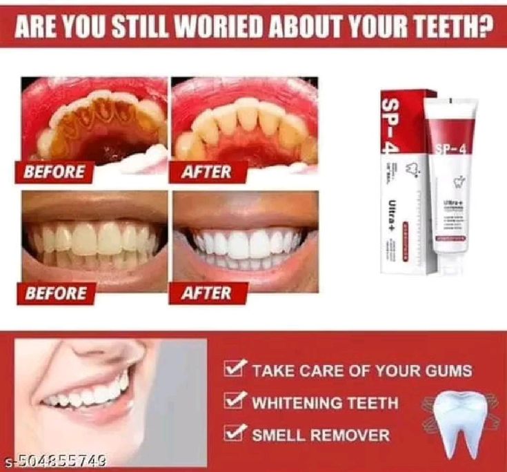 Transformez votre sourire dès aujourd’hui avec SP-4 Ultra+ – La solution avancée pour des dents visiblement plus blanches