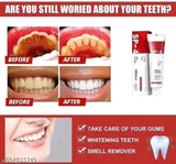 Transformez votre sourire dès aujourd’hui avec SP-4 Ultra+ – La solution avancée pour des dents visiblement plus blanches